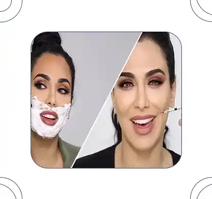نحوه اصلاح صورت بعد از بوتاکس
