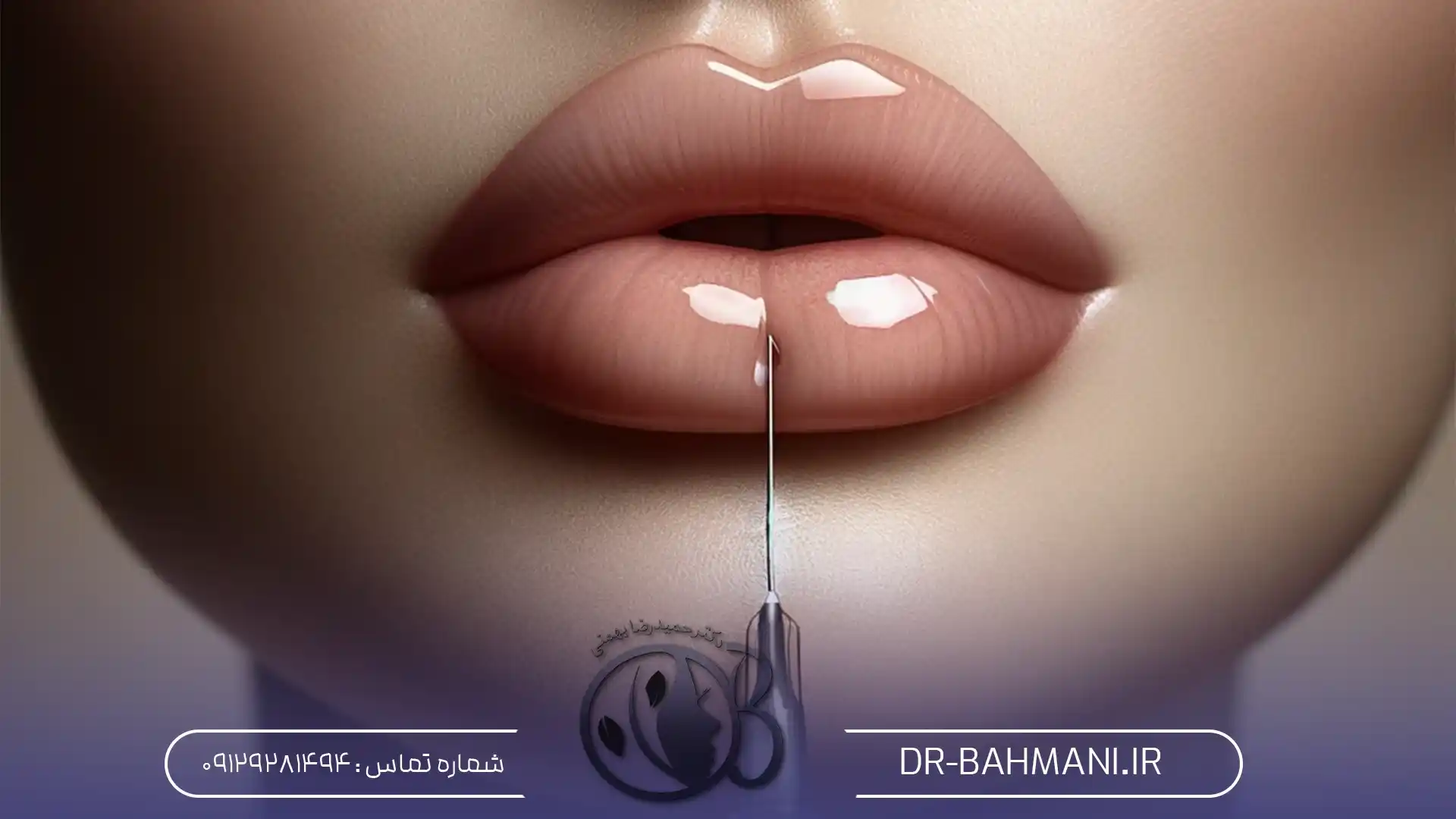 Lip gel injection, round model