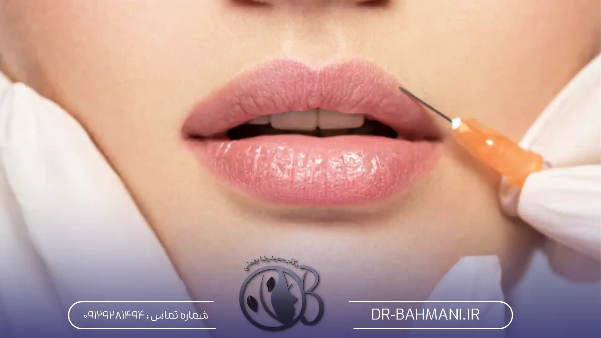 عوامل موثر ماندگاری تزریق ژل لب