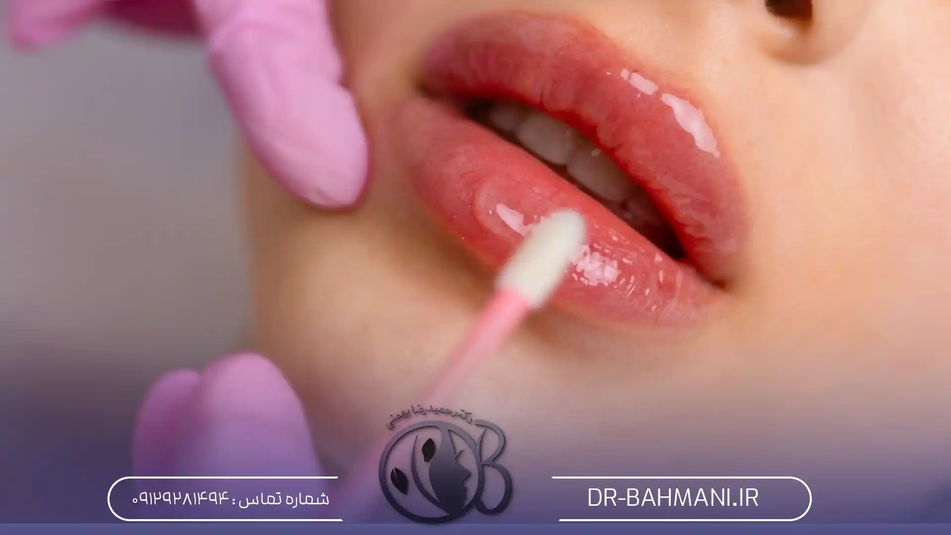 ماندگاری تزریق ژل لب