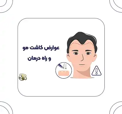 Complications of hair transplant