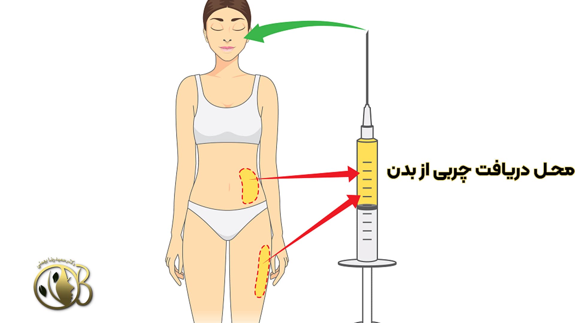 محل دریافت چربی از بدن