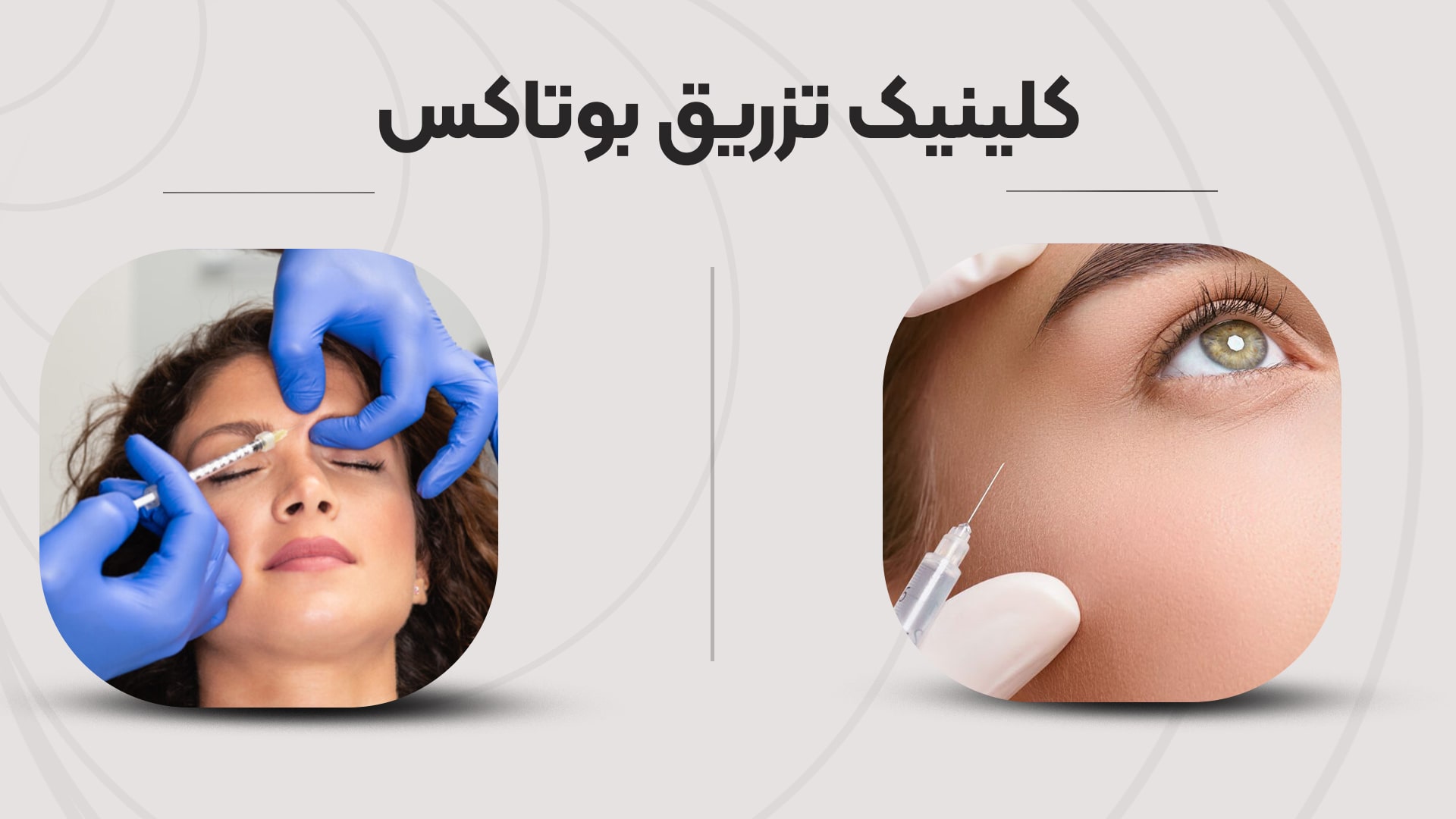 بهترین کلینیک تزریق بوتاکس در تهران