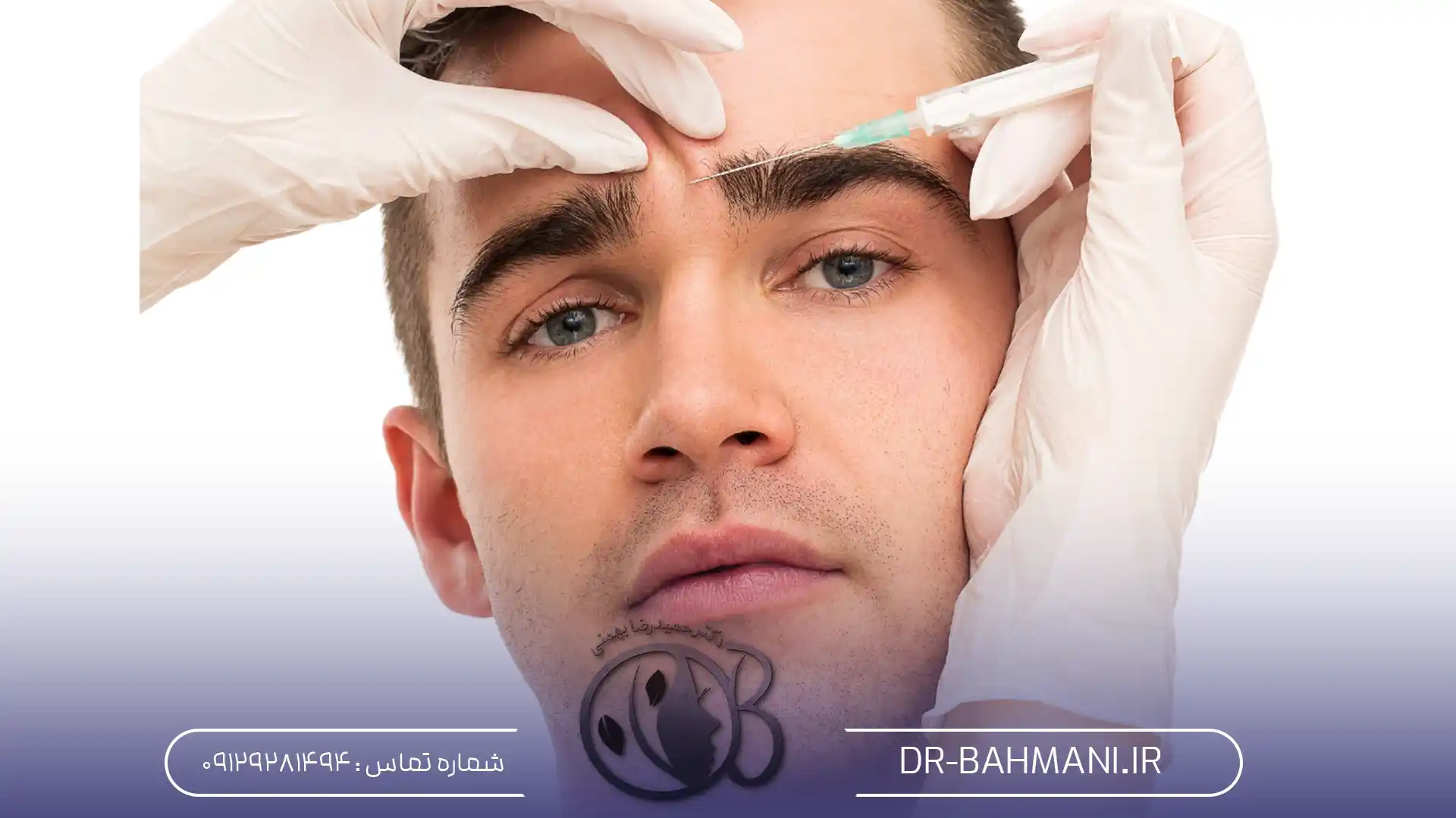 بوتاکس پیشانی مردان