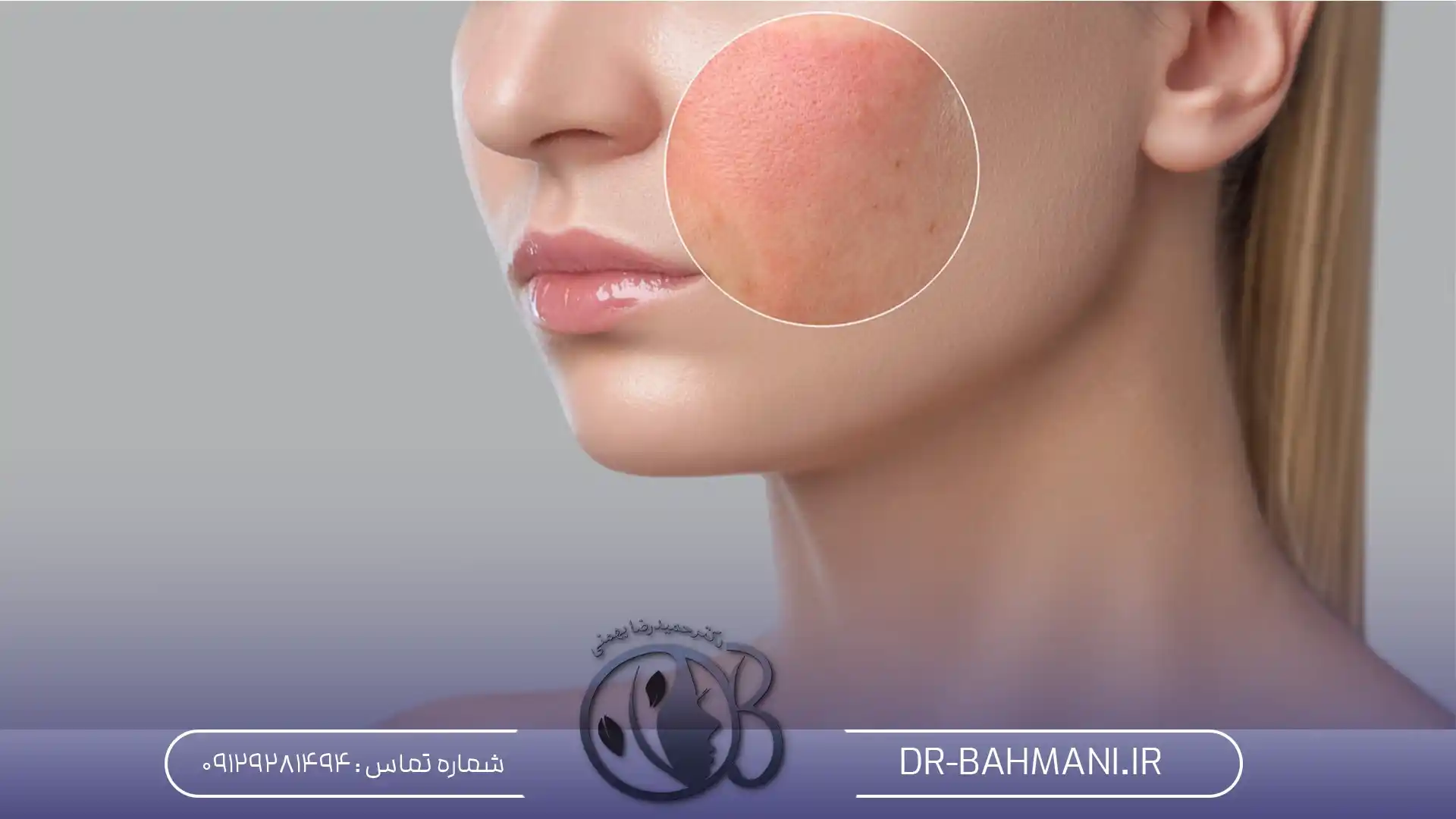 عوارض اندولیفت