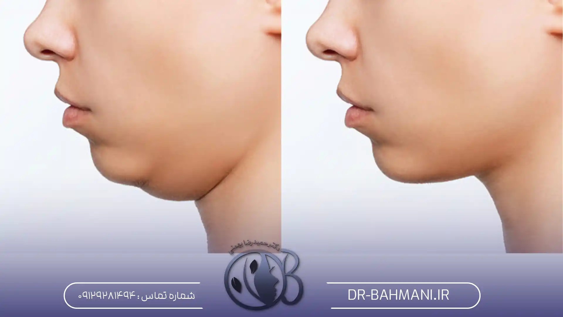 غبغب