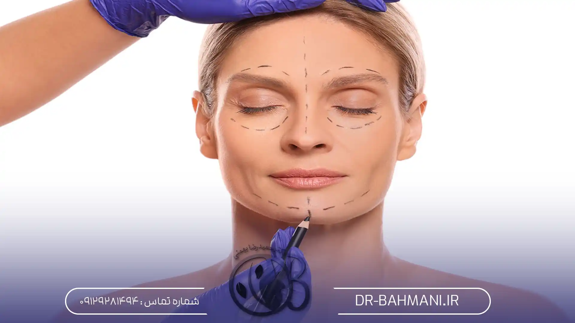 ژینوپلاستی