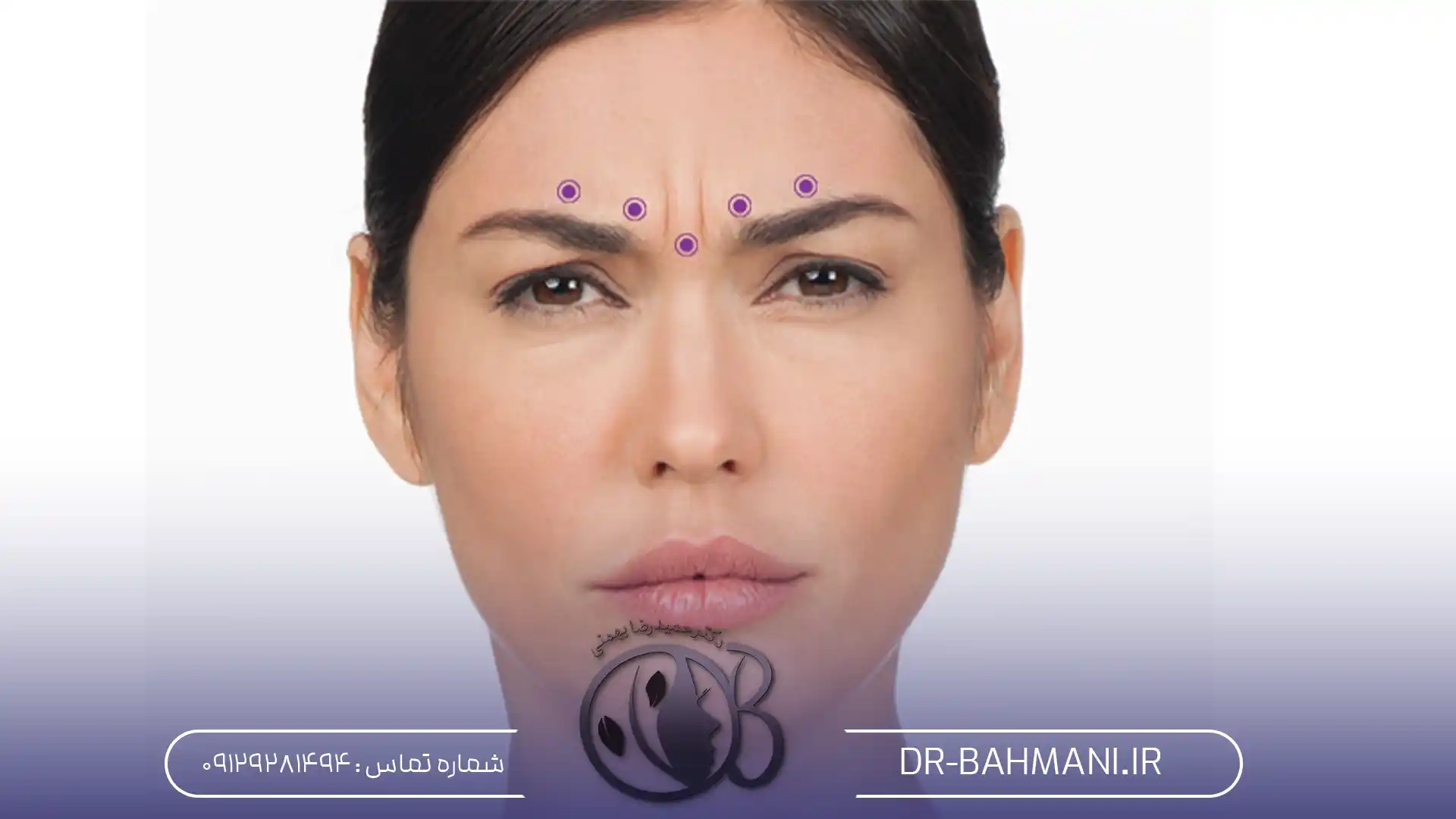 نواحی بوتاکس خط اخم