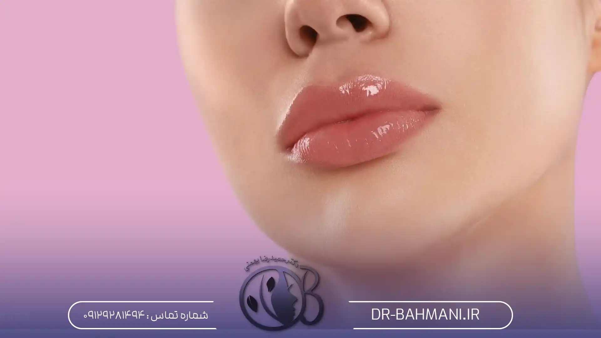 تزریق فیلر لب مدل M