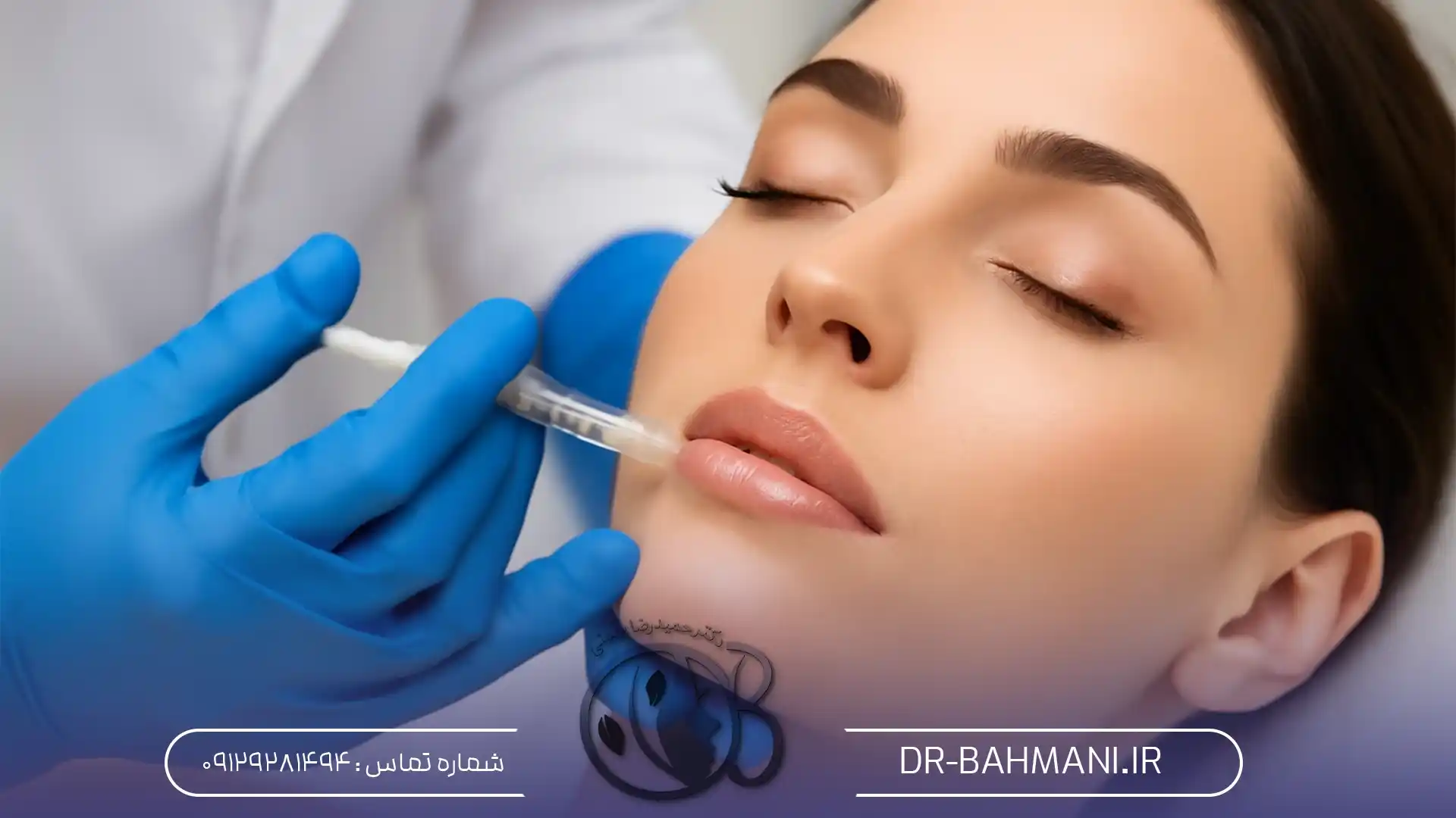 تزریق ژل لب برای لب های باریک