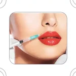 تزریق فیلر لب با تکنیک M | فرم‌دهی طبیعی