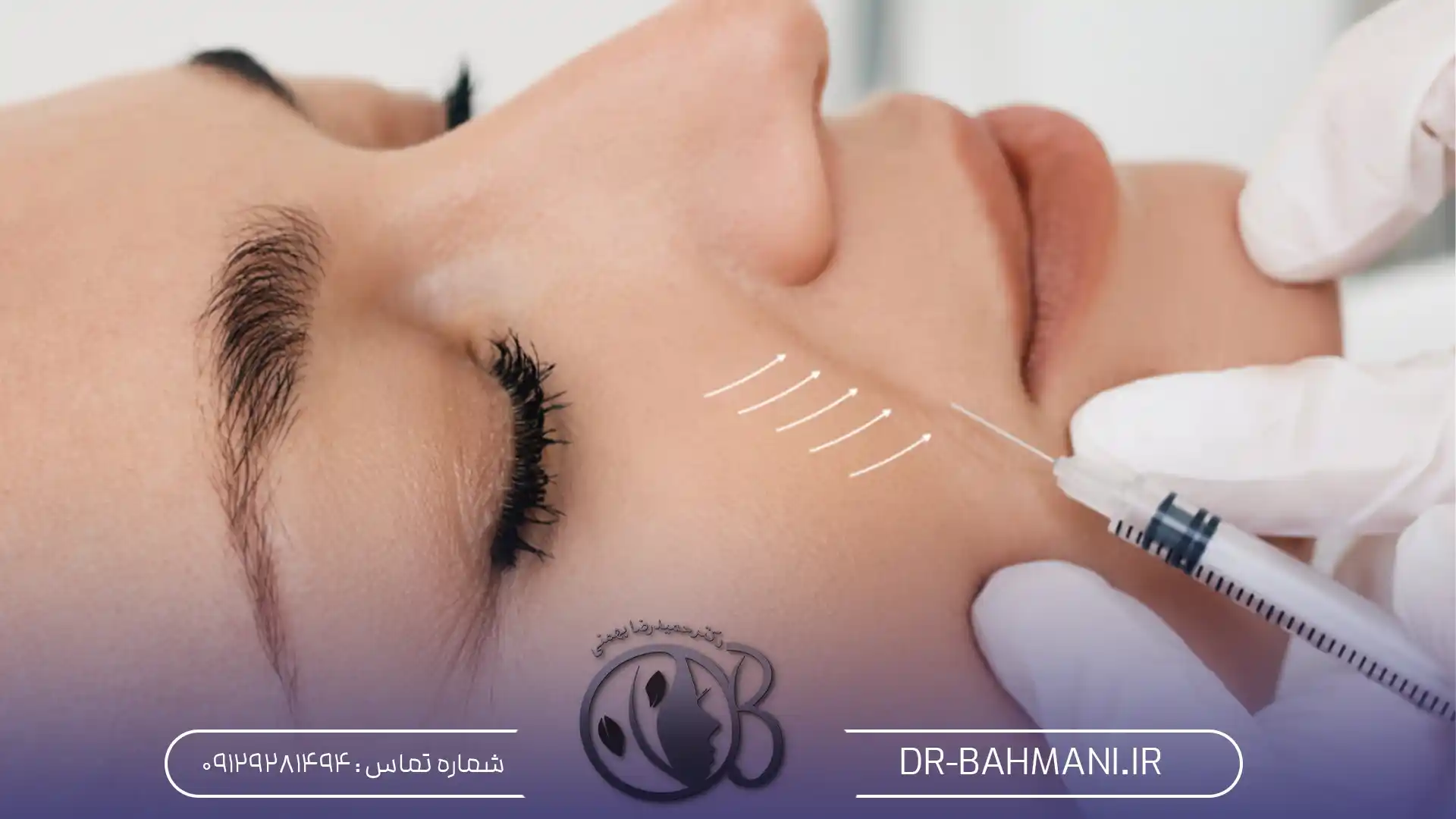 مزایای پروفایلو